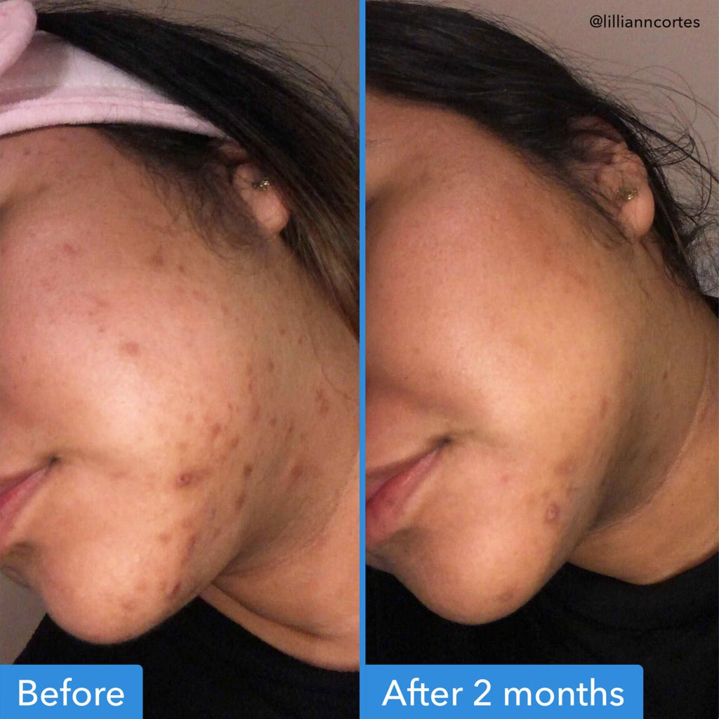 Discoloration Correcting Serum E5