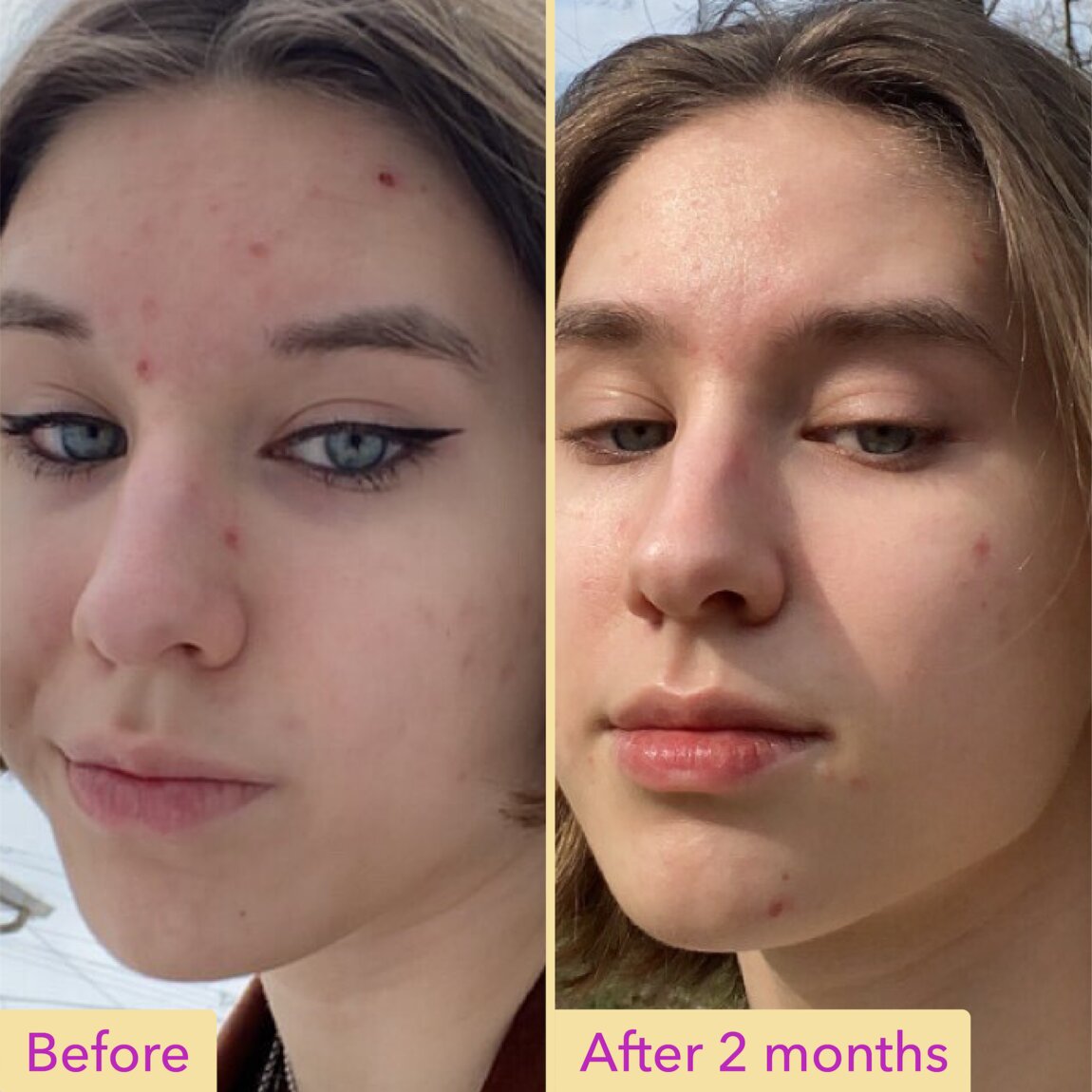 Niacinamide Serum L3