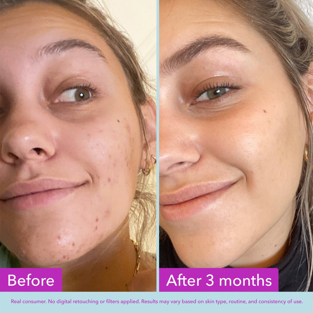Niacinamide Brightening Toner N4