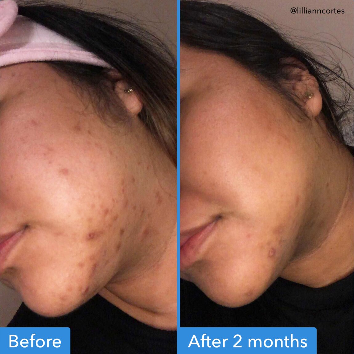 Discoloration Correcting Serum Q0