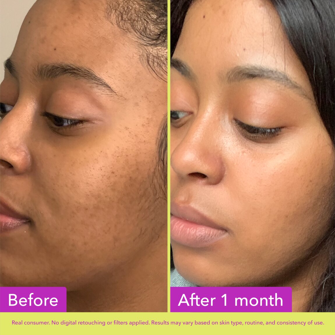 Glycolic Exfoliating Toner H4